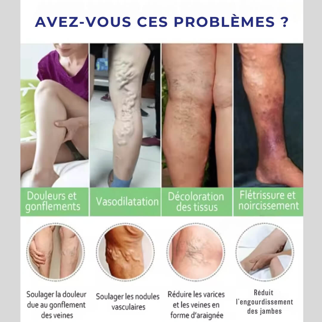 VarixCare Laser® – Traitement des varices 3ᵉ génération
