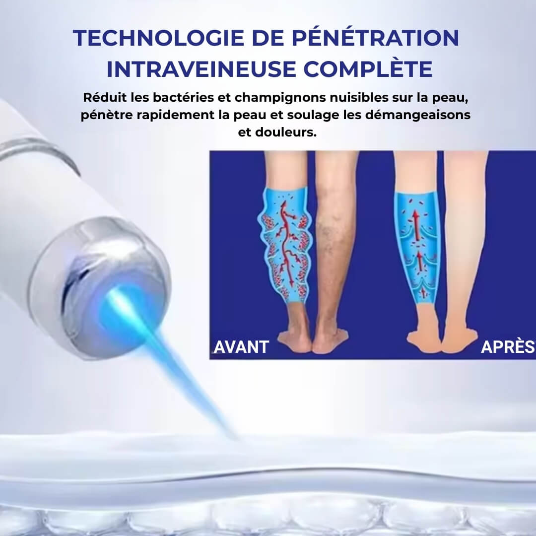 VarixCare Laser® – Traitement des varices 3ᵉ génération